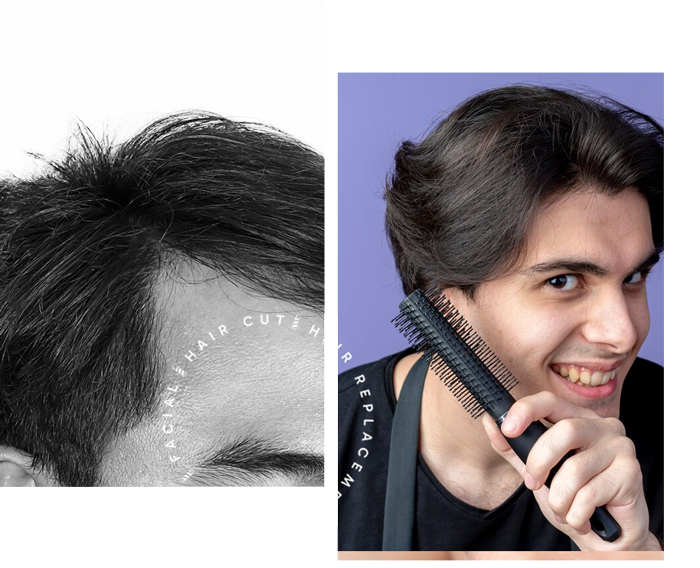 Men's Hair Replacement System in Stafford