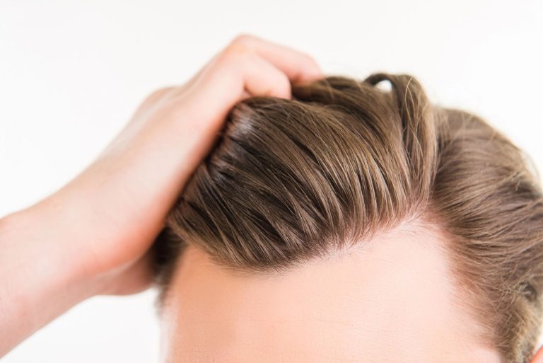 A hand adjusting a natural-looking men's toupee on a head, showcasing quality hairpieces in Stafford.